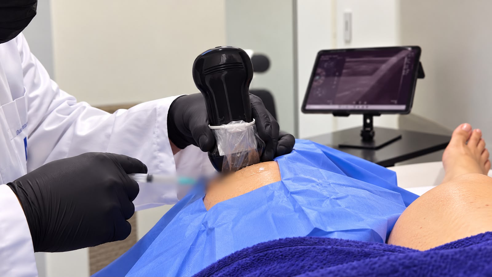 Procedimento de infiltração com seringa, transdutor de ultrassom e monitor do exame visíveis